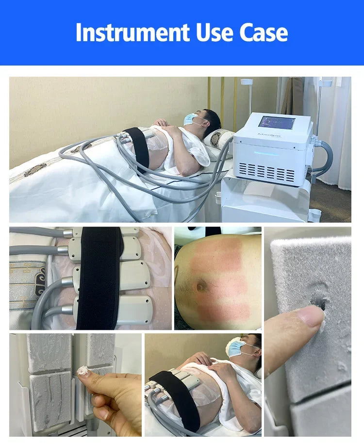 Máquina Criolipolise EMS com Estimulação Muscular - Equipamento Profissional Modelação Corporal