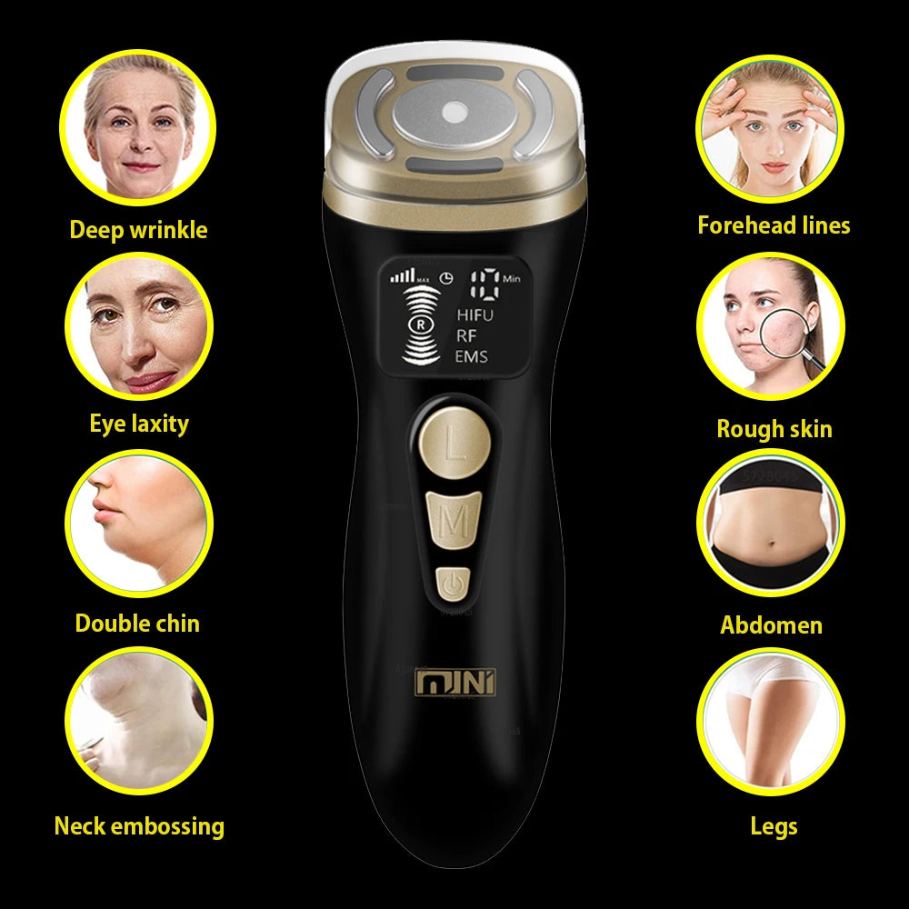 HIFU 2.0 Mini Preto - Ultrassom RF EMS Microcorrente Lifting Facial e Firmeza
