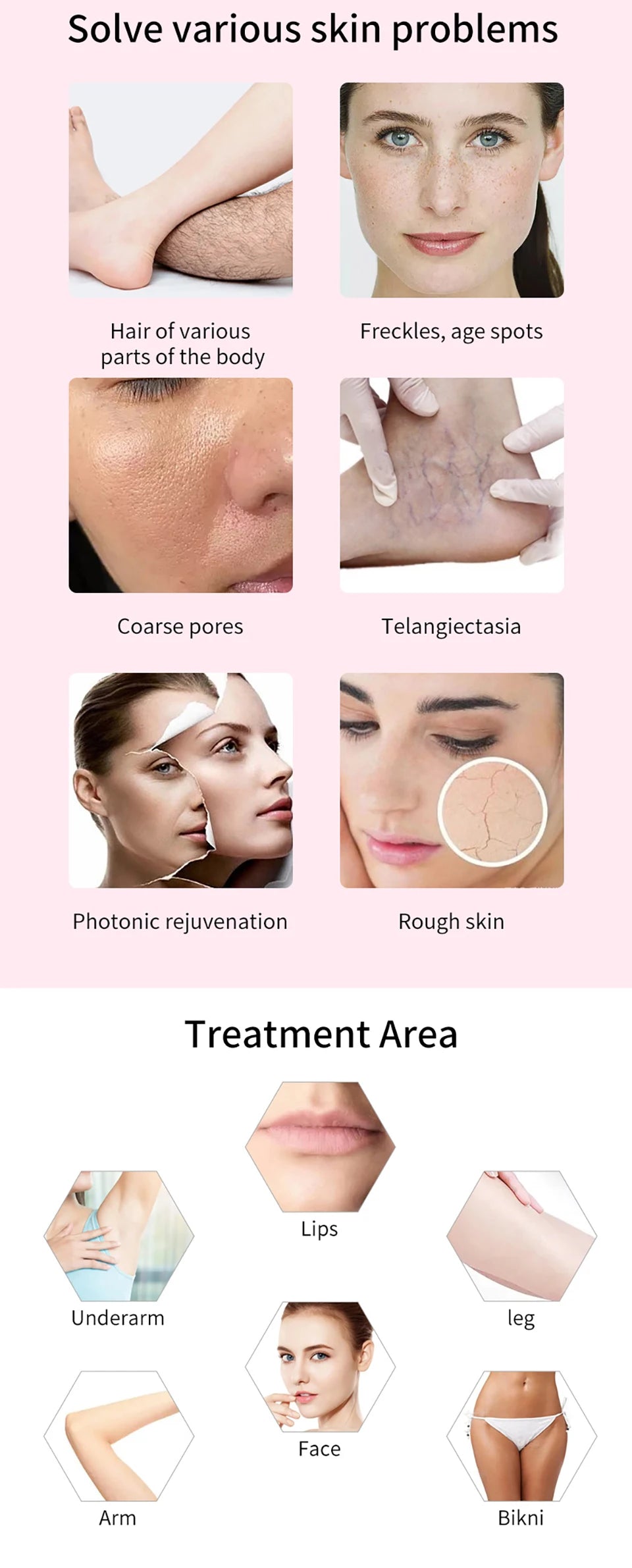 Máquina IPL Profissional Depilação Laser - Equipamento Salão Beleza Remoção Permanente Elight OPT Indolor