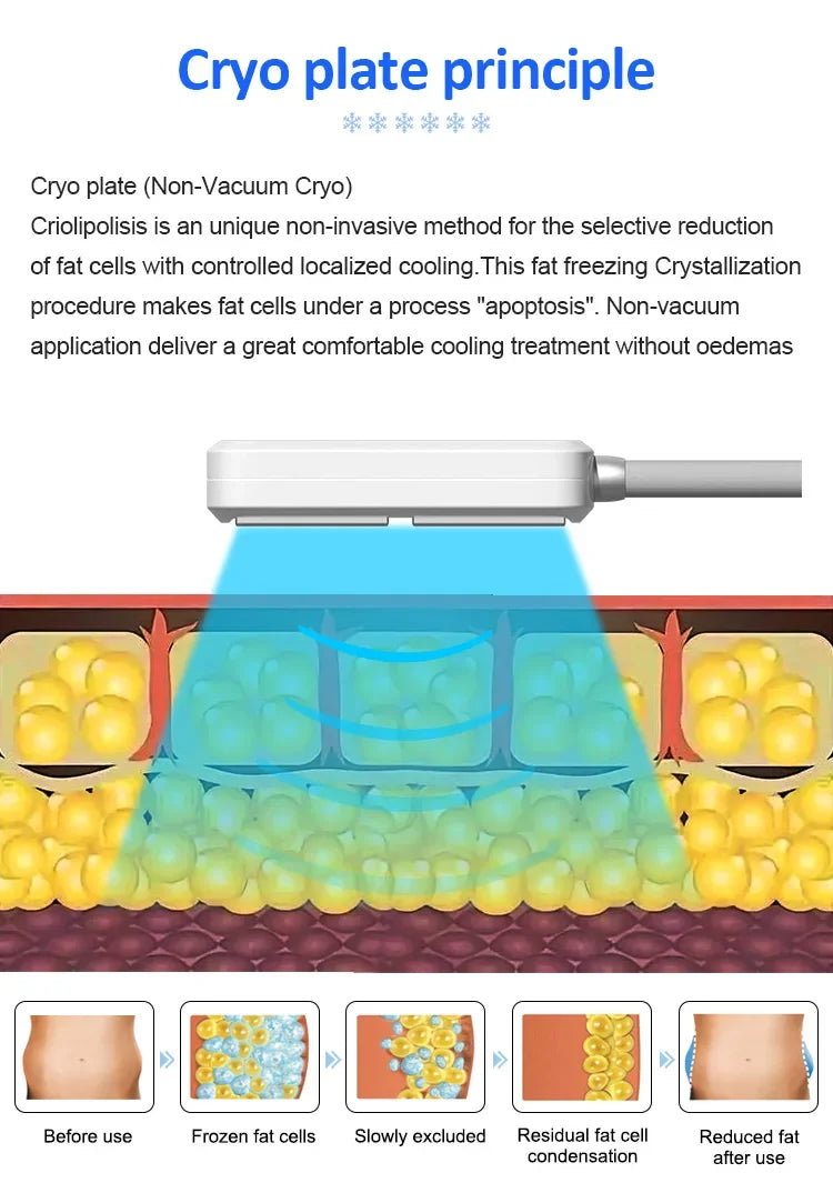 Máquina Criolipolise EMS com Estimulação Muscular - Equipamento Profissional Modelação Corporal