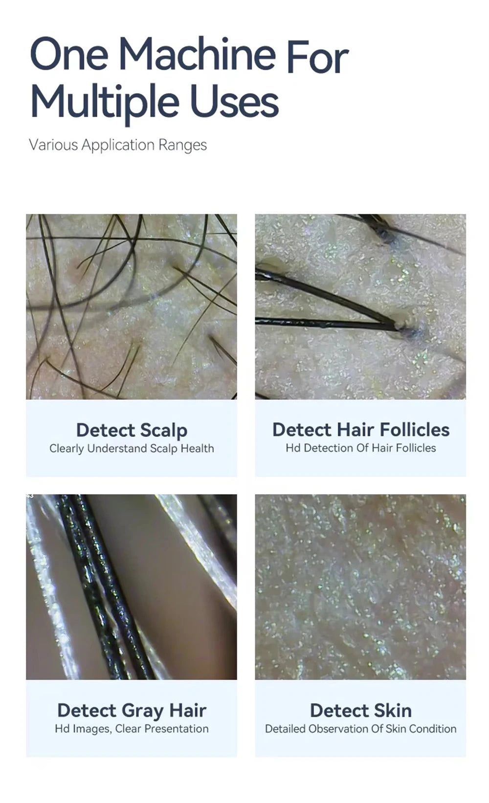 Dermatoscópio Eletrônico Câmera Couro Cabeludo - Analisador Pele Facial Profissional Microscópio Digital Ampliador Poros