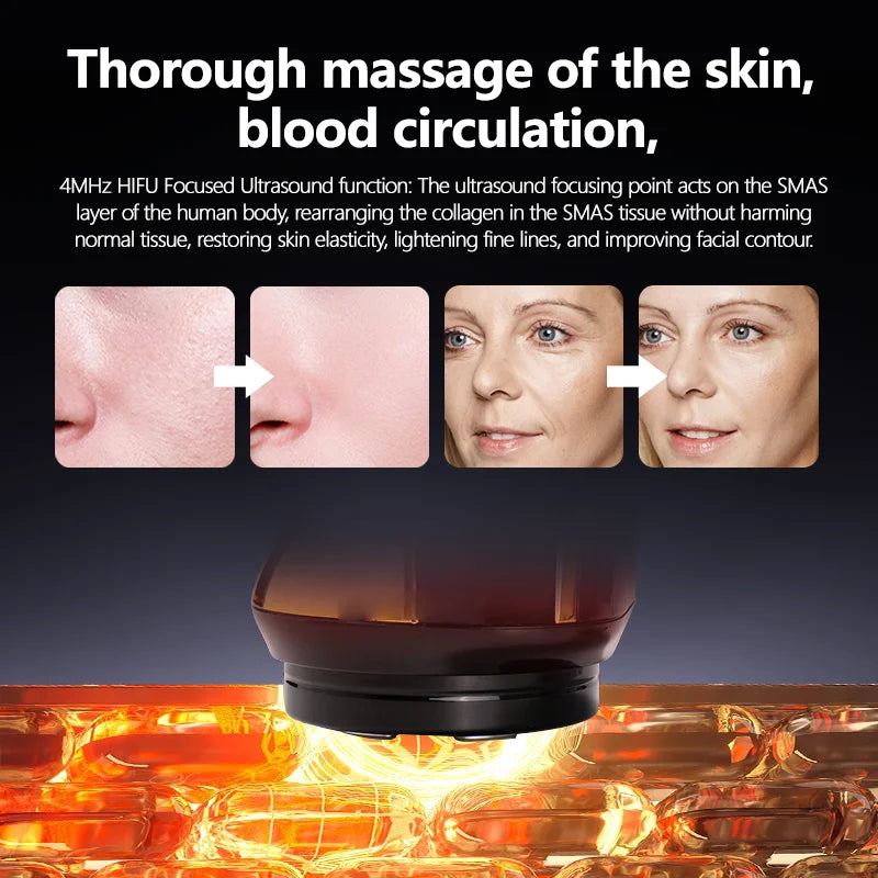 Máquina HIFU Mini 4 em 1 3ª Geração - EMS Aquecimento Massageador Facial Corpo Ultrassom