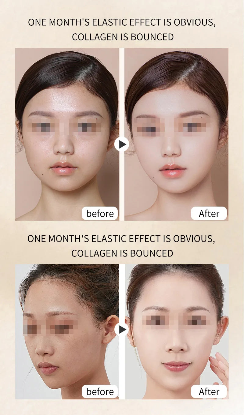 Máquina HIFU Lifting Facial Uso Doméstico - Rejuvenescimento Firmeza Remoção Rugas Anti-Envelhecimento