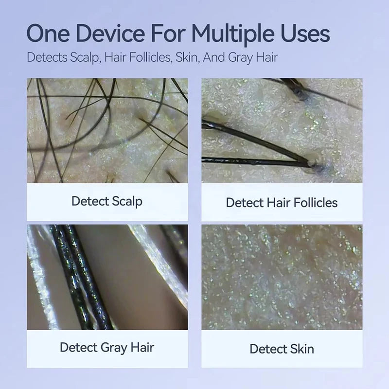 Dermatoscópio Eletrônico Câmera Couro Cabeludo - Analisador Pele Facial Profissional Microscópio Digital Ampliador Poros