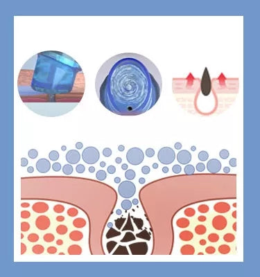 Equipamento Estético Feminino 14 em 1 - Oxigenação Bolhas e Hidrodermabrasão Facial