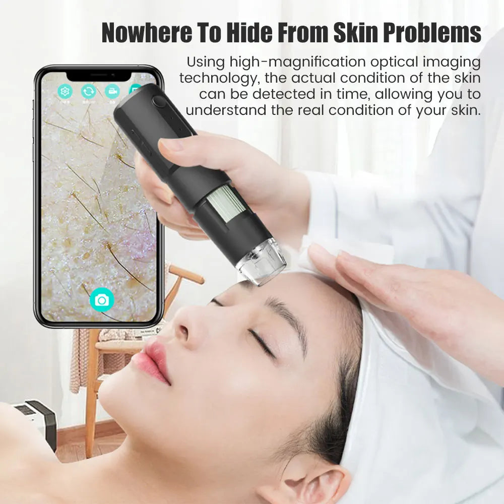 Dermatoscópio Wireless Analisador Pele Couro Cabeludo - Máquina Análise Facial Corporal Microscópio Eletrônico Profissional
