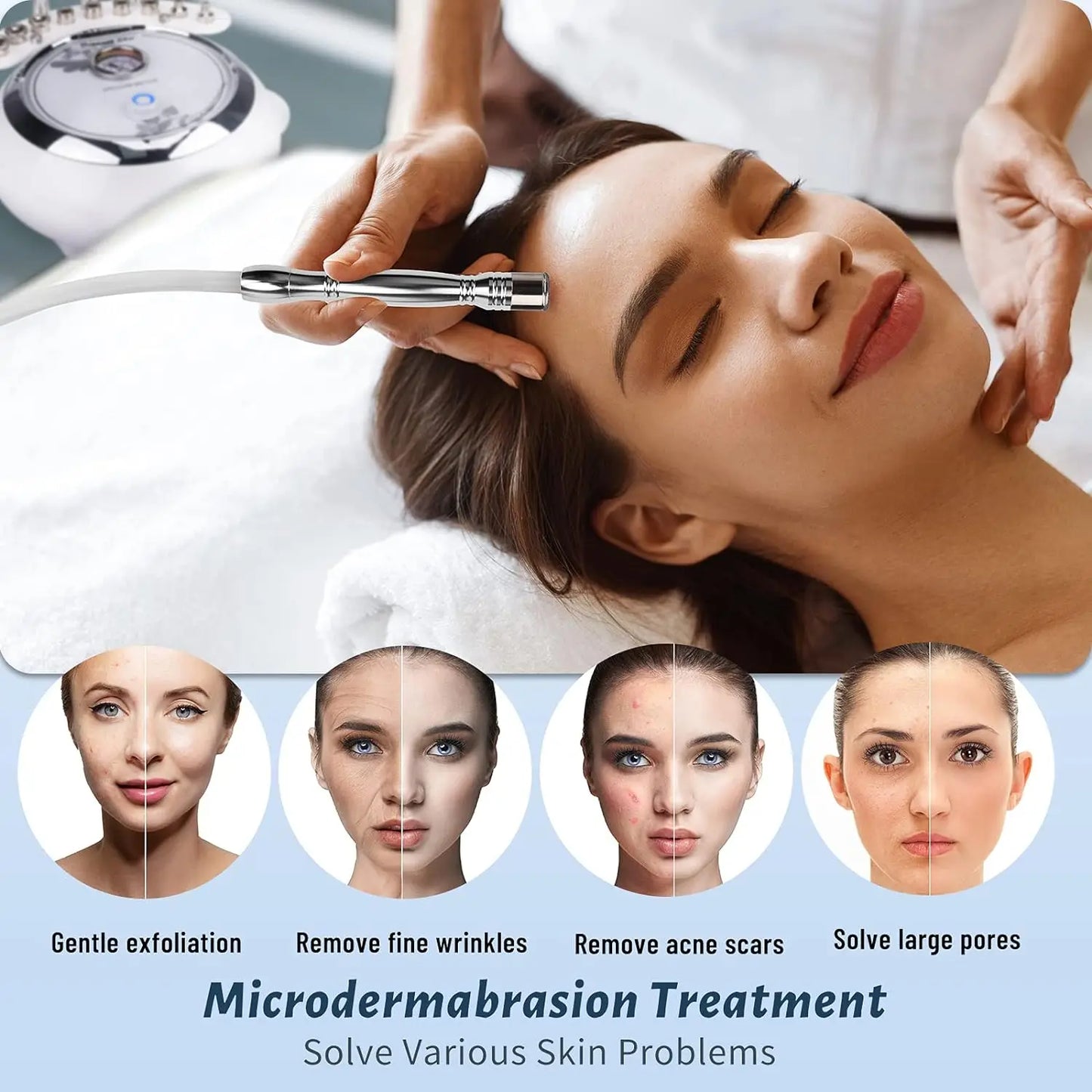 Máquina 3 em 1 Microdermoabrasão Diamante - Equipamento Profissional 65-68cmHg para Cuidados Faciais