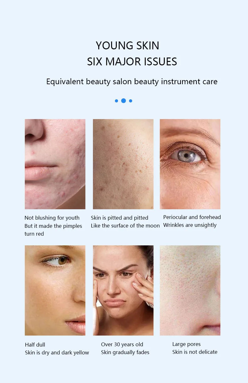 Caneta Nano Microagulhamento Facial - Dispositivo Cuidados Pele LED Fóton Vibração Massageador Mesogun Aplicador Sérum