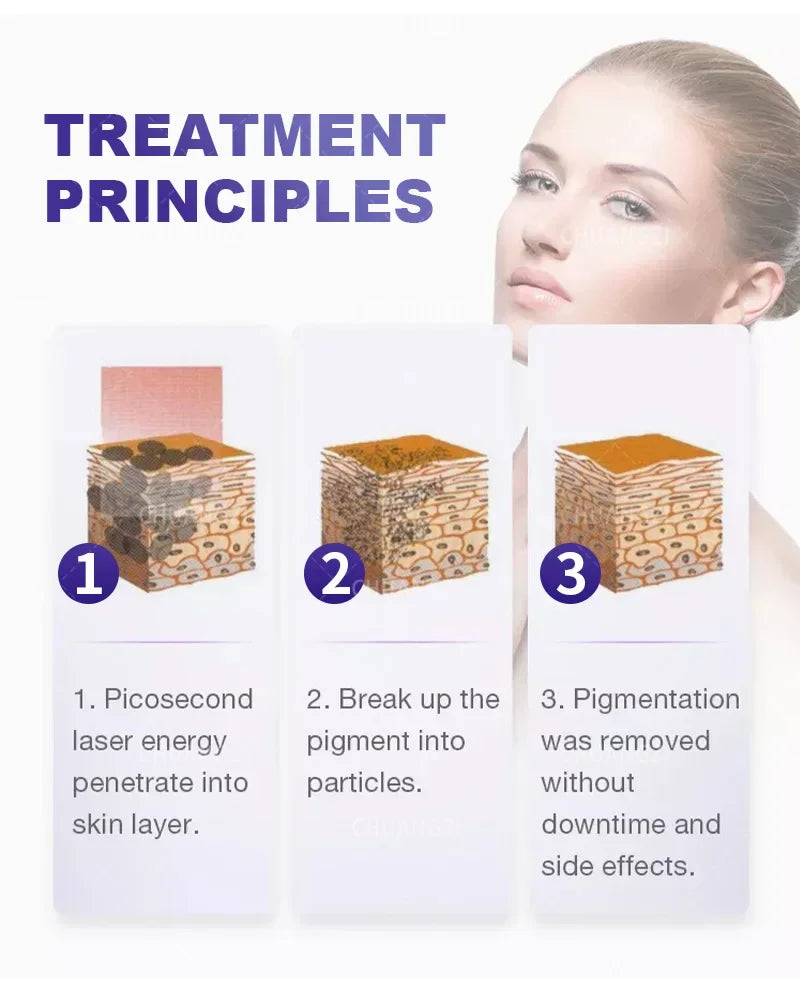 Máquina Laser Diodo Multifuncional 2 em 1 - Depilação e Remoção Tatuagens 3 Comprimentos Onda