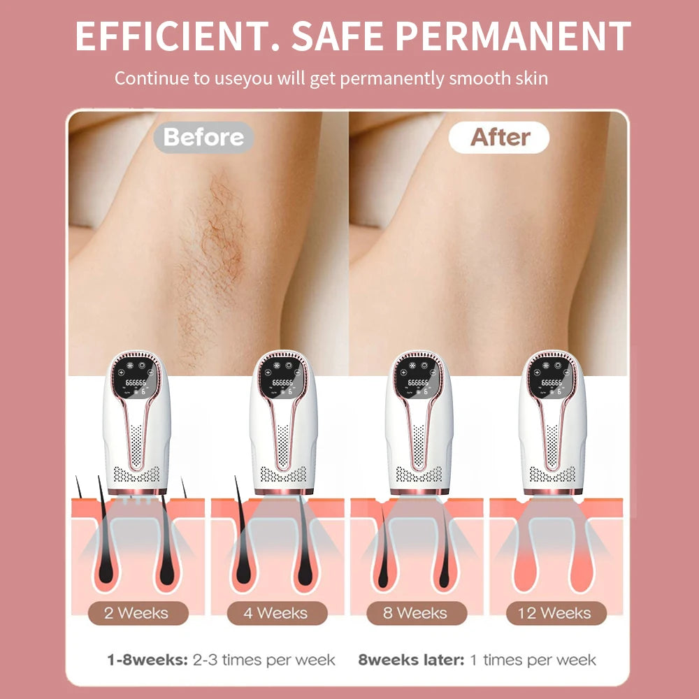 Depilador IPL Laser Feminino Profissional - Luz Pulsada Elétrico Rosto Corpo Biquíni 999.999 Flashes