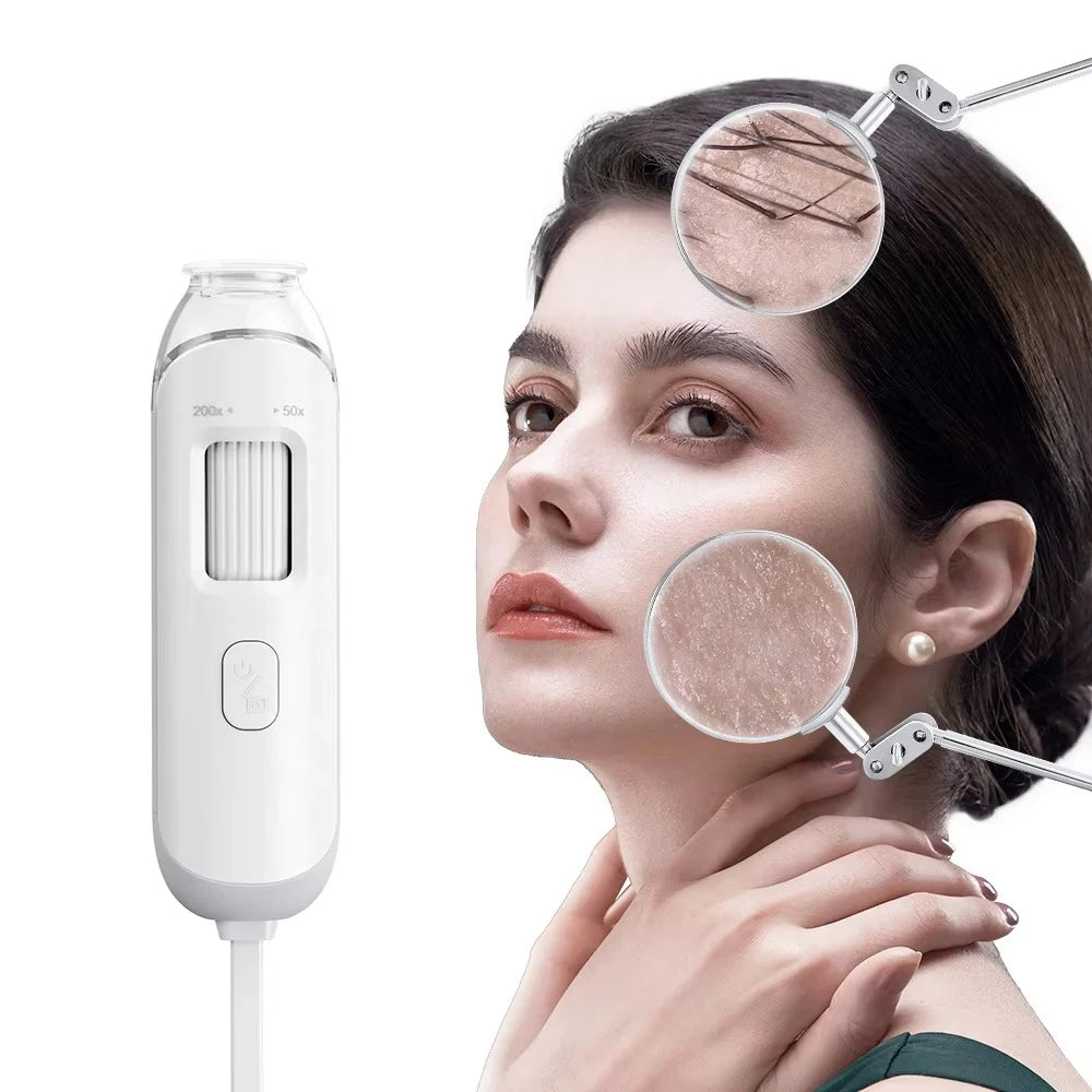 Dermatoscópio Eletrônico Câmera Couro Cabeludo - Analisador Pele Facial Profissional Microscópio Digital Ampliador Poros