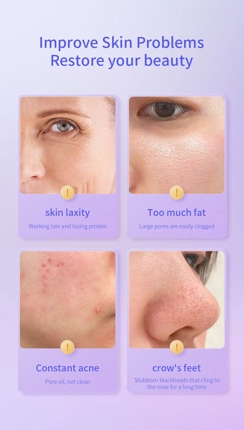 Skin Cool - Máquina de Beleza Facial Cryo-Eletroporação com Lifting e Circulação Linfática