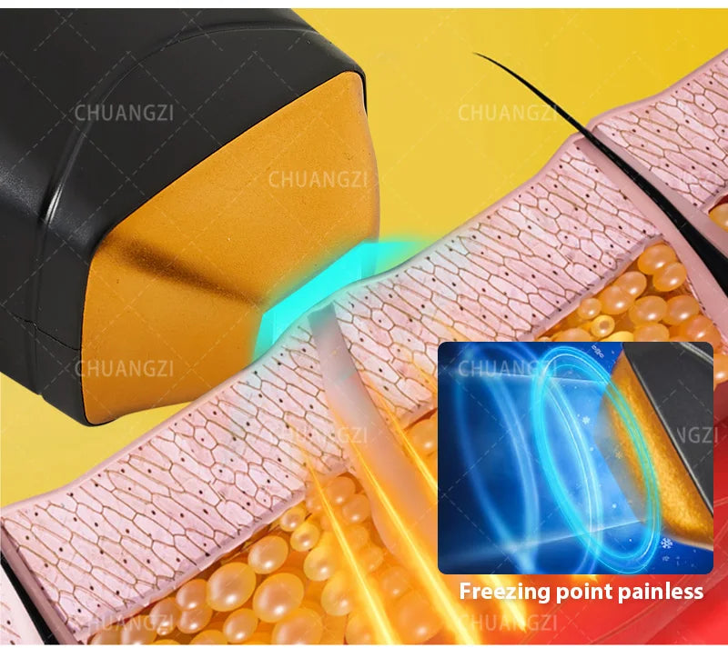 Máquina Laser Diodo Ice Painless 3 Wavelengths 755nm 808nm 1064nm - Depilação Definitiva Todos Tons Pele