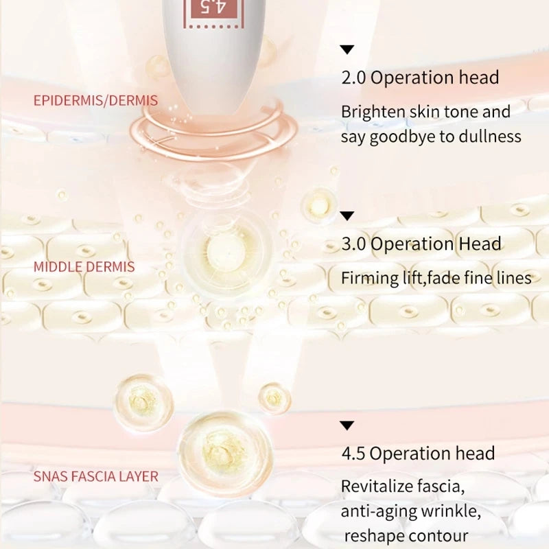 Máquina HIFU Lifting Facial Uso Doméstico - Rejuvenescimento Firmeza Remoção Rugas Anti-Envelhecimento