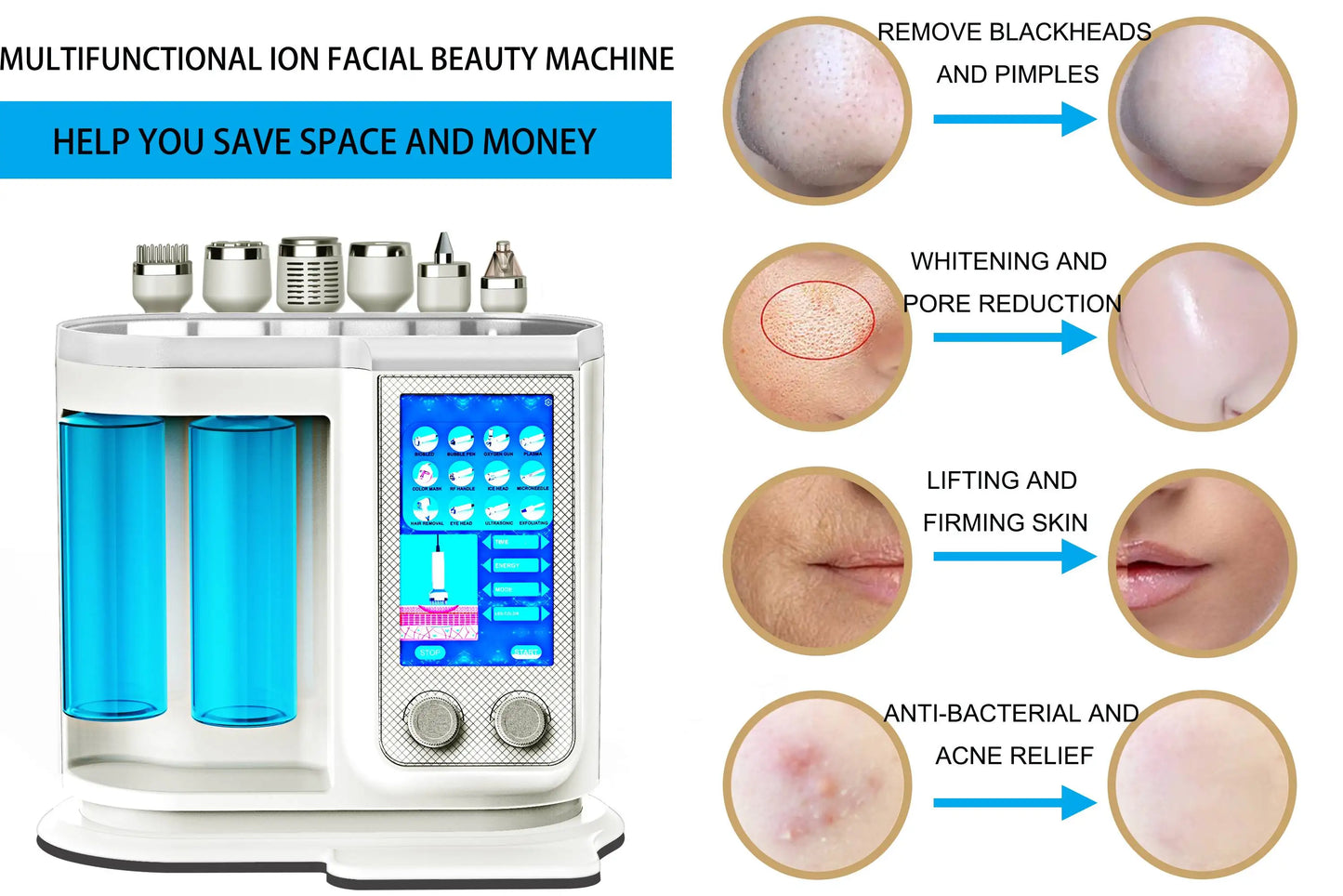 Máquina Hydra Facial Profissional RF Bio Lifting - Microdermoabrasão e Dermoabrasão Aquática