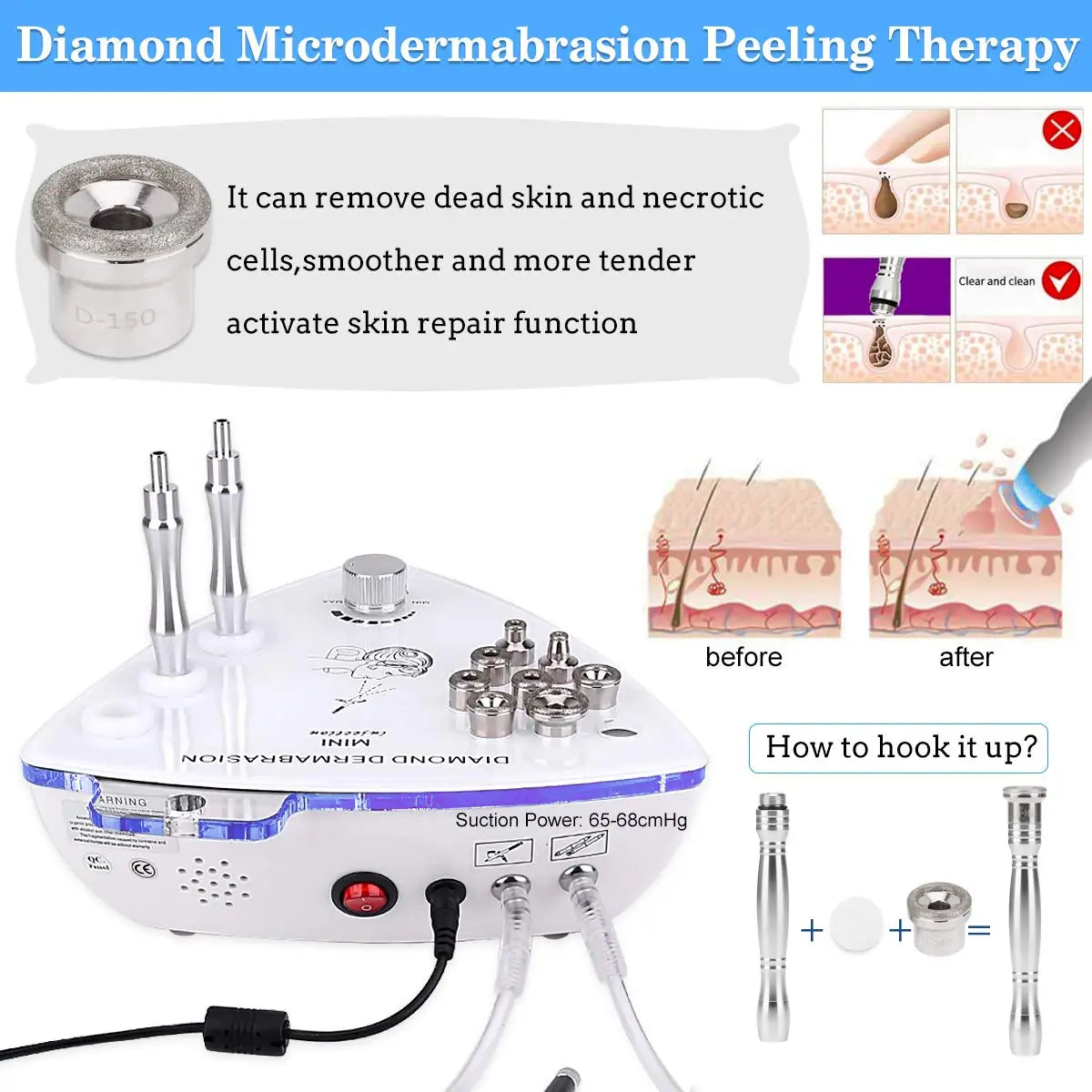 Máquina Microdermoabrasão Diamante Profissional - 65-68cmHg com 9 Pontas para Esfoliação Facial