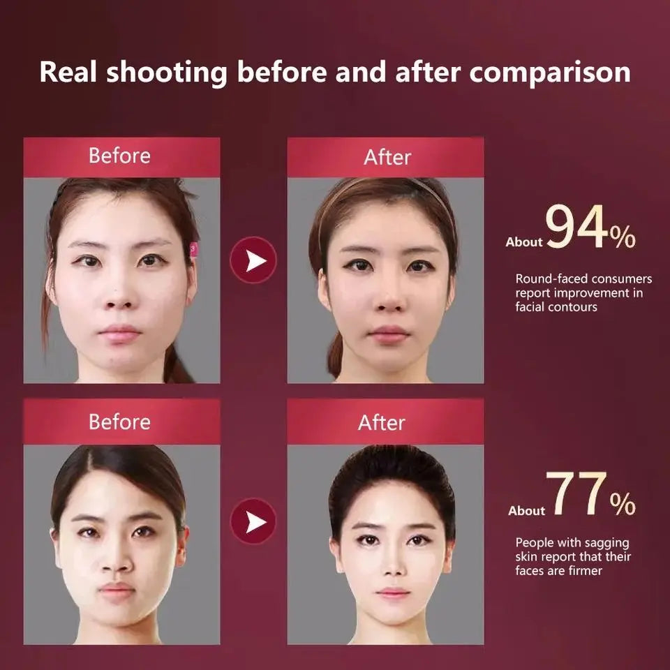 Dispositivo Lifting Facial LED Fototerapia - Massageador Vibracional Aquecido Papada Rosto V