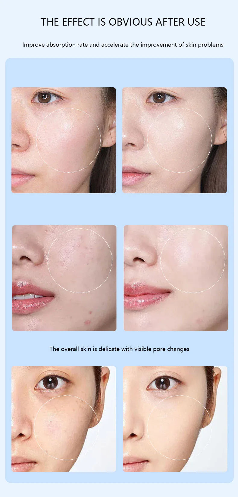 Caneta Nano Microagulhamento Facial - Dispositivo Cuidados Pele LED Fóton Vibração Massageador Mesogun Aplicador Sérum