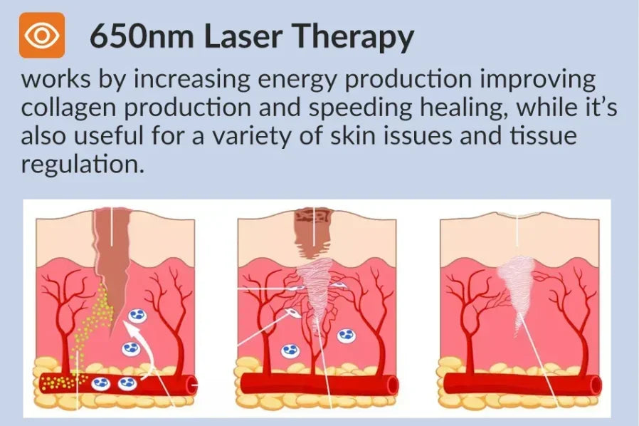 Laser Terapêutico LLLT Profissional 650nm/880nm - Alívio da Dor e Fisioterapia