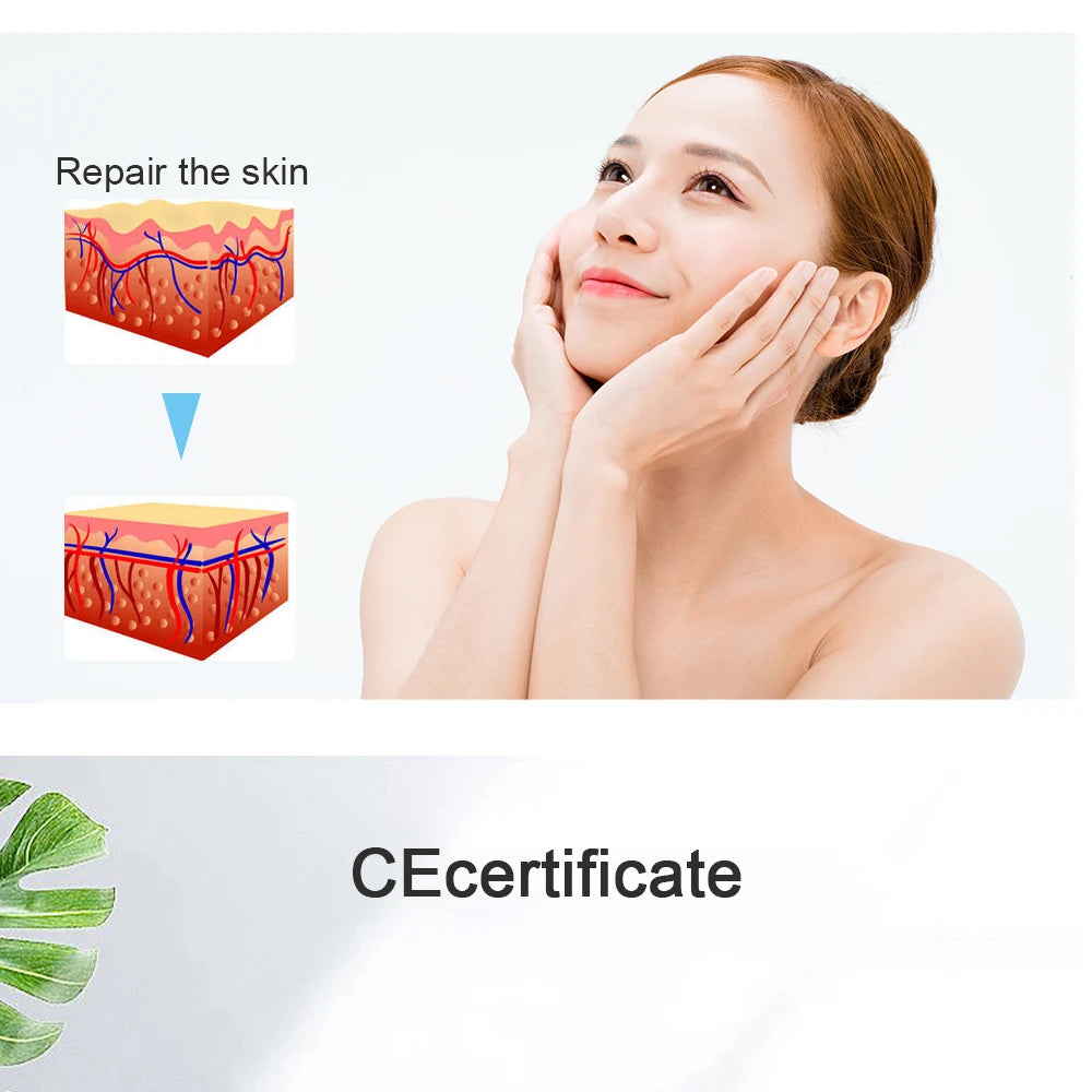 Máquina Microdermoabrasão Facial Beemyi - Pontas Diamante para Rejuvenescimento e Esfoliação