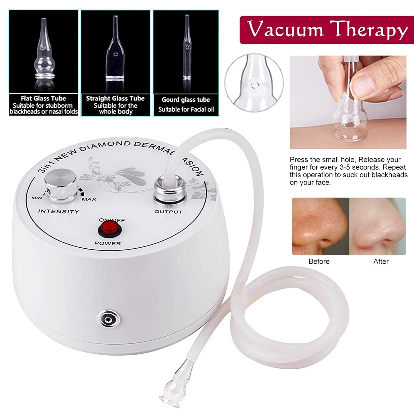 Máquina Microdermoabrasão Diamante Profissional - Peeling Facial Cuidados Pele Remoção Pontos Negros