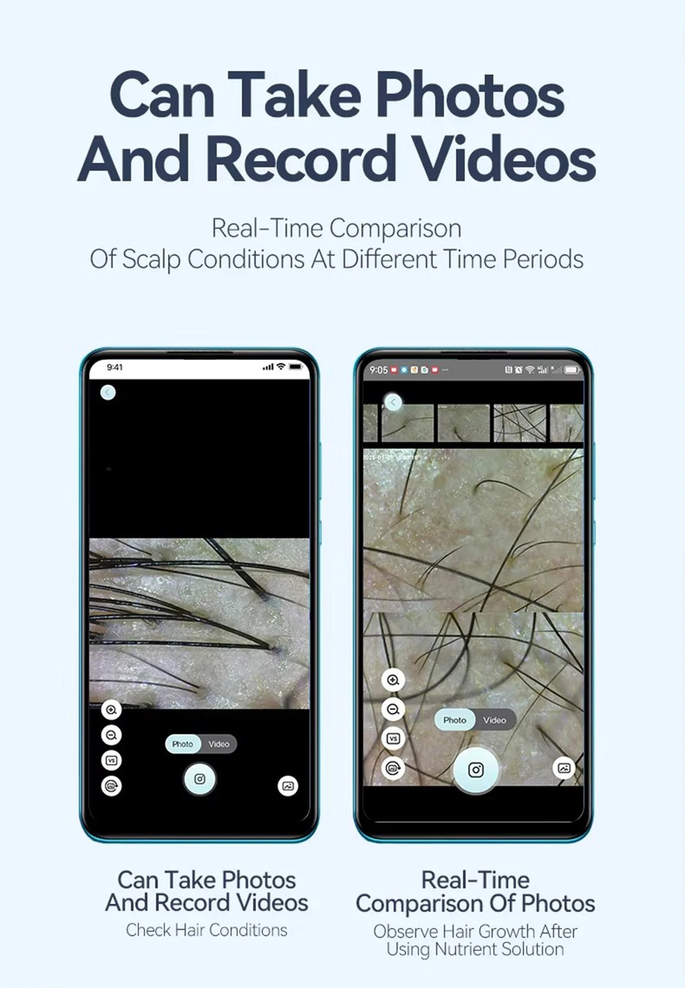 Dermatoscópio Eletrônico Câmera Couro Cabeludo - Analisador Pele Facial Profissional Microscópio Digital Ampliador Poros