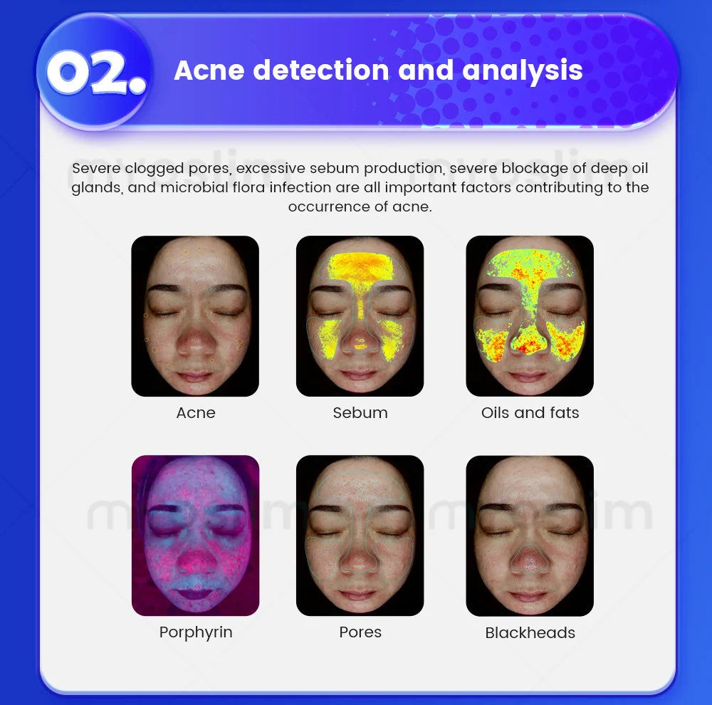 Analisador 3D Facial AI 15.6/21.5 Polegadas - Máquina Análise Pele Inteligência Artificial Scanner Couro Cabeludo