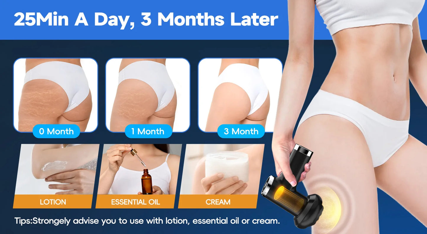 Máquina Body Sculpting Elétrica Anti-Celulite - 5 Cabeças Massagem Rotativa Corpo Inteiro Relaxamento