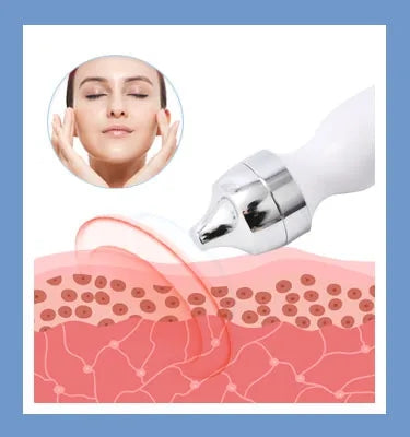 Equipamento Estético Feminino 14 em 1 - Oxigenação Bolhas e Hidrodermabrasão Facial