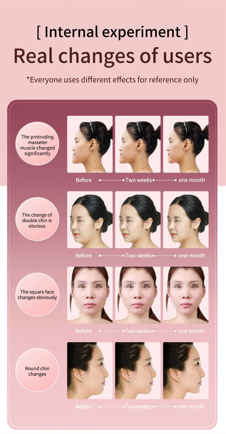 Dispositivo Lifting Facial LED Fototerapia - Massageador Vibracional Aquecido Papada Rosto V