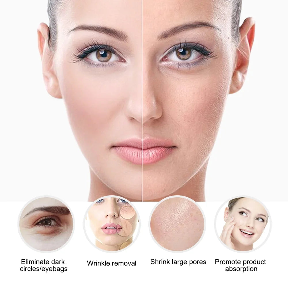 Cryo COOL - Máquina de Crioterapia com Terapia LED Anti-Acne e Eletroporação