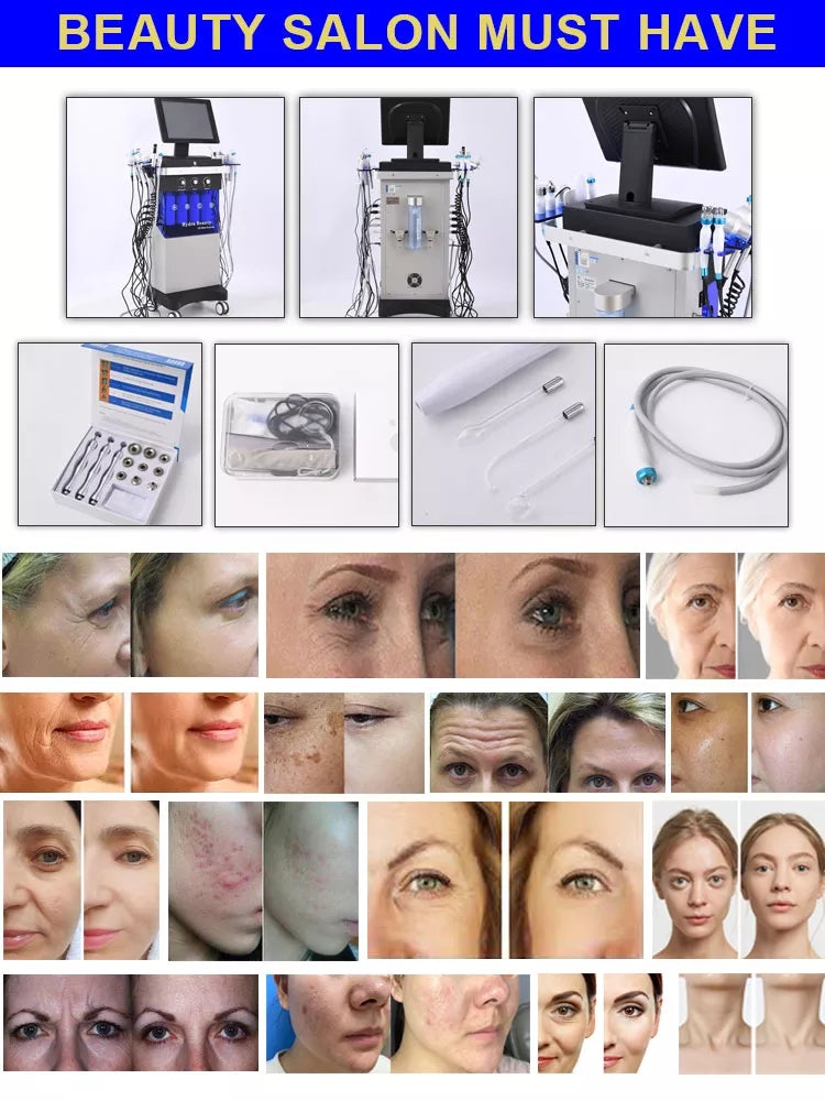 Equipamento Estético Feminino 14 em 1 - Oxigenação Bolhas e Hidrodermabrasão Facial