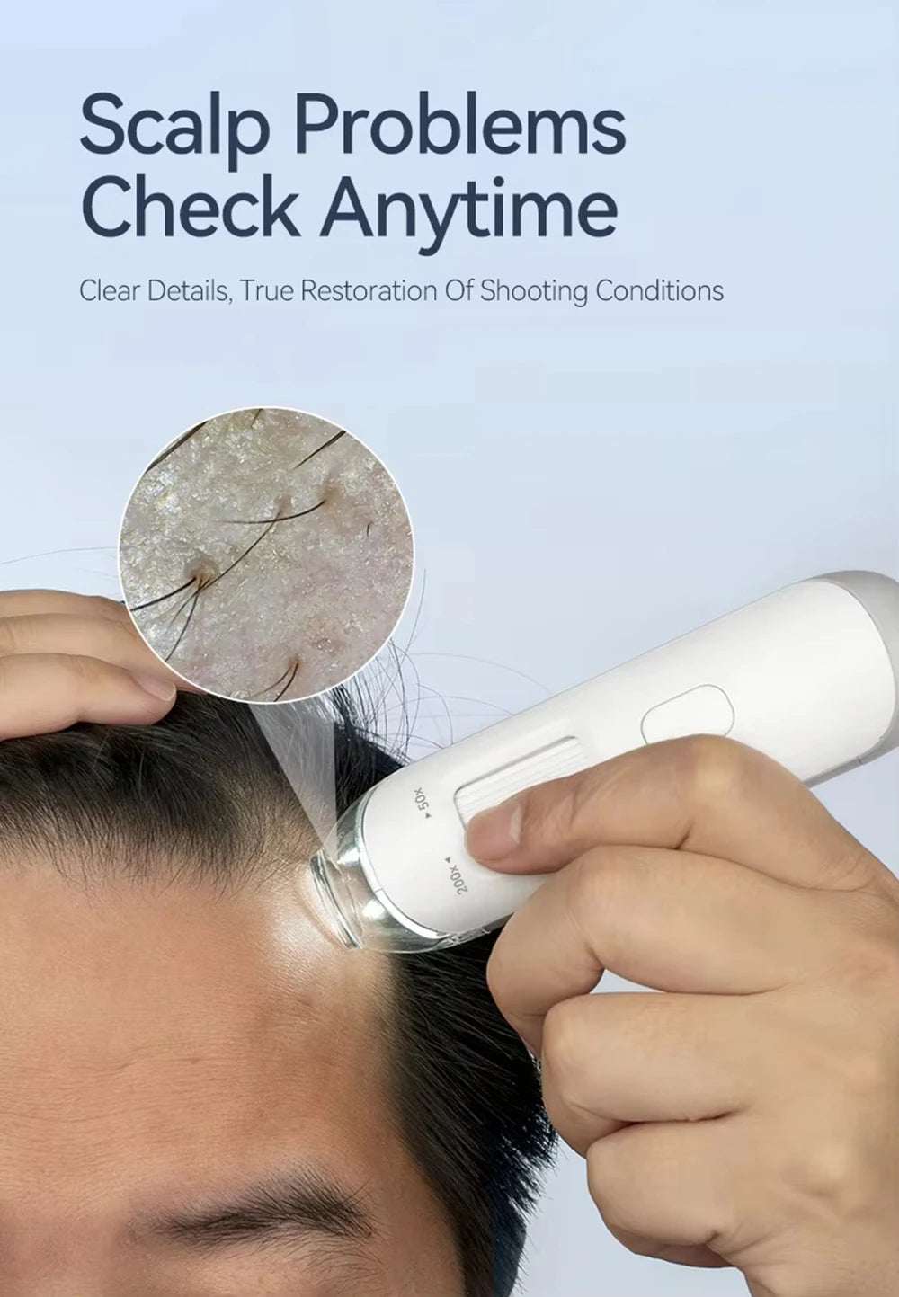 Dermatoscópio Eletrônico Câmera Couro Cabeludo - Analisador Pele Facial Profissional Microscópio Digital Ampliador Poros