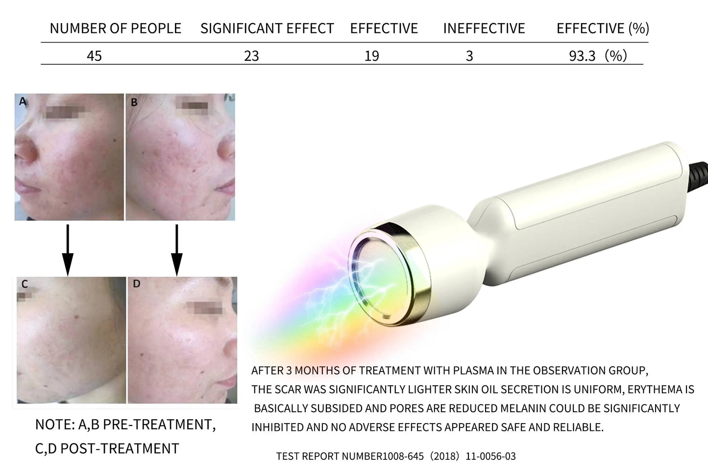 Máquina Hydra Facial Profissional RF Bio Lifting - Microdermoabrasão e Dermoabrasão Aquática