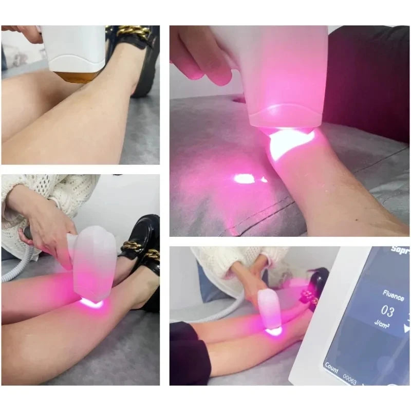 Depiladora Laser Diodo 808nm - Remoção Permanente Indolor com Sistema Ice Platinum