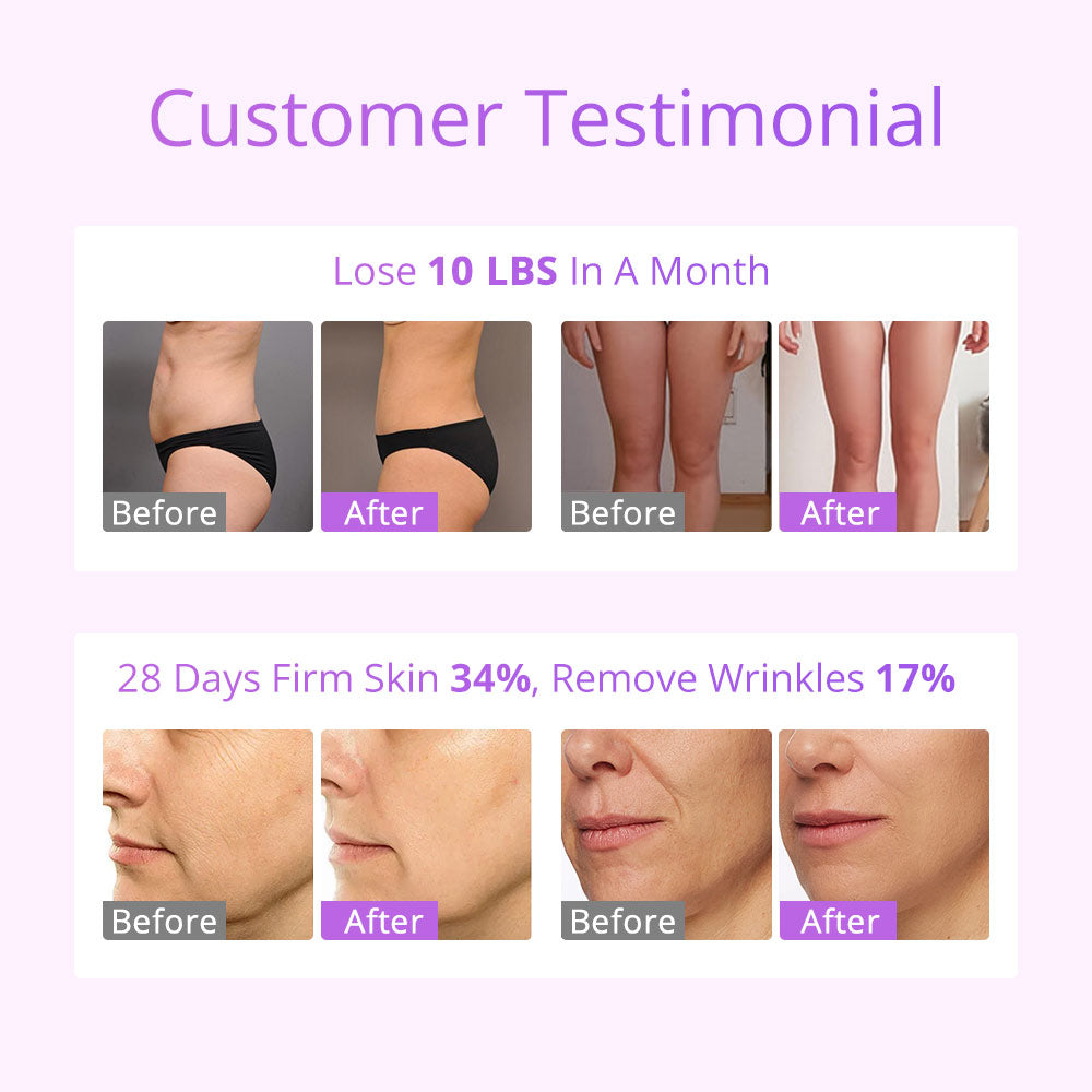 Máquina Cavitação Ultrassónica 5 em 1 - Laser Lipo 30K com Vácuo para Modelagem Corporal