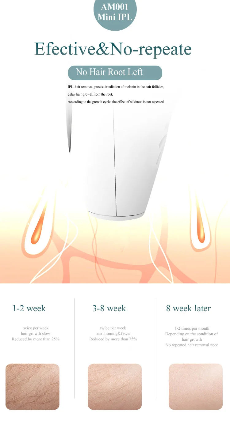 Depilador IPL Profissional Permanente - Remoção Pelos Corpo Inteiro Casa Mulheres 900.000 Flashes