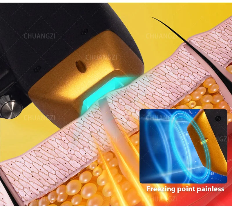 Máquina Laser Diodo Portátil 808nm 3 Wavelengths - Depilação Permanente Ice Alexandrite