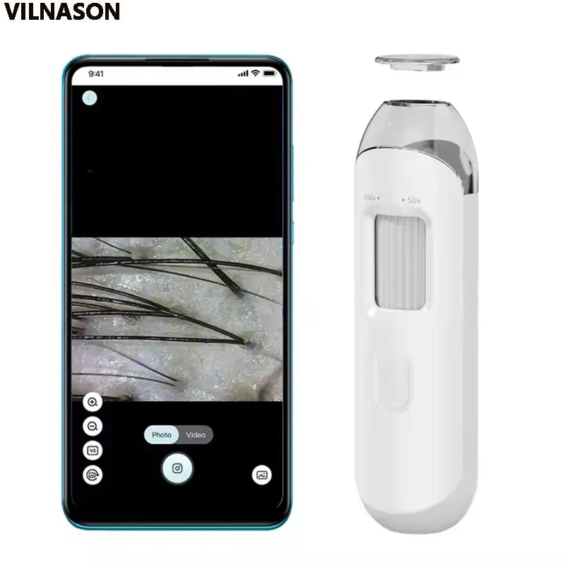 Dermatoscópio Eletrônico Câmera Couro Cabeludo - Analisador Pele Facial Profissional Microscópio Digital Ampliador Poros