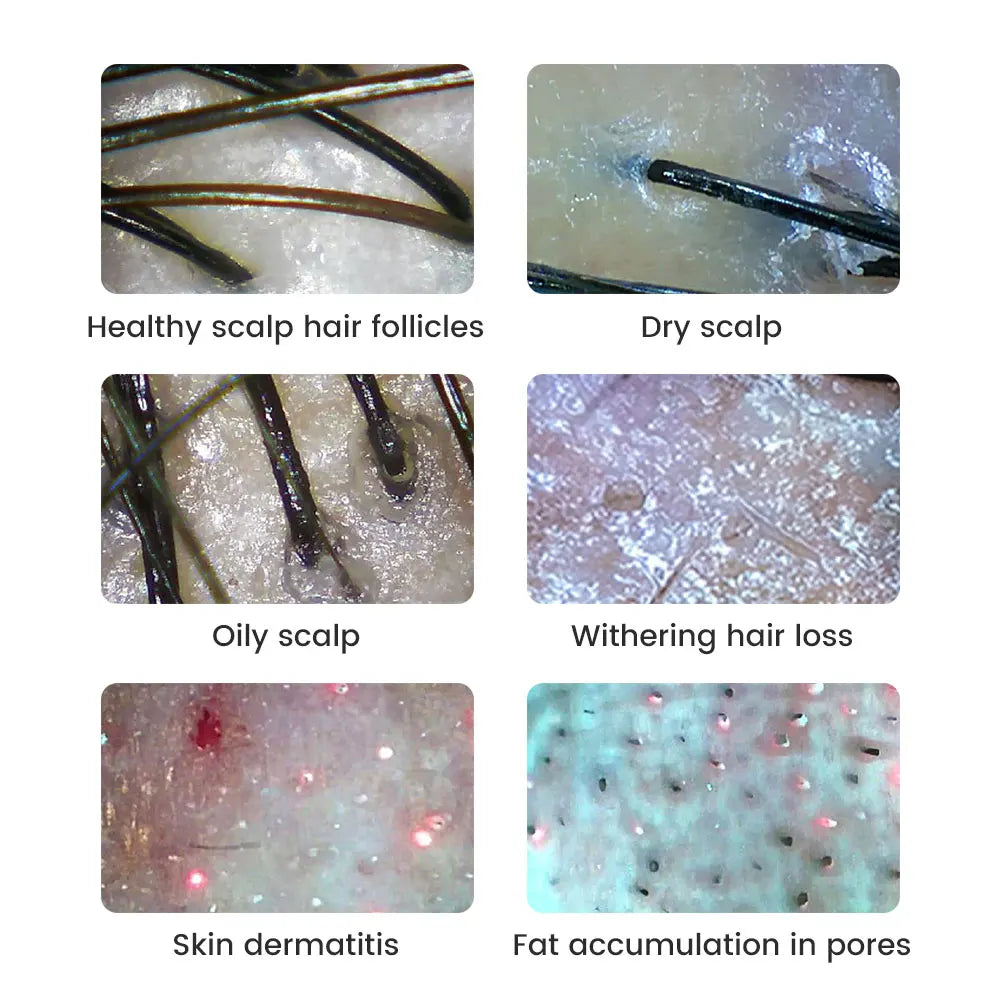 Dermatoscópio Wireless Analisador Pele Couro Cabeludo - Máquina Análise Facial Corporal Microscópio Eletrônico Profissional