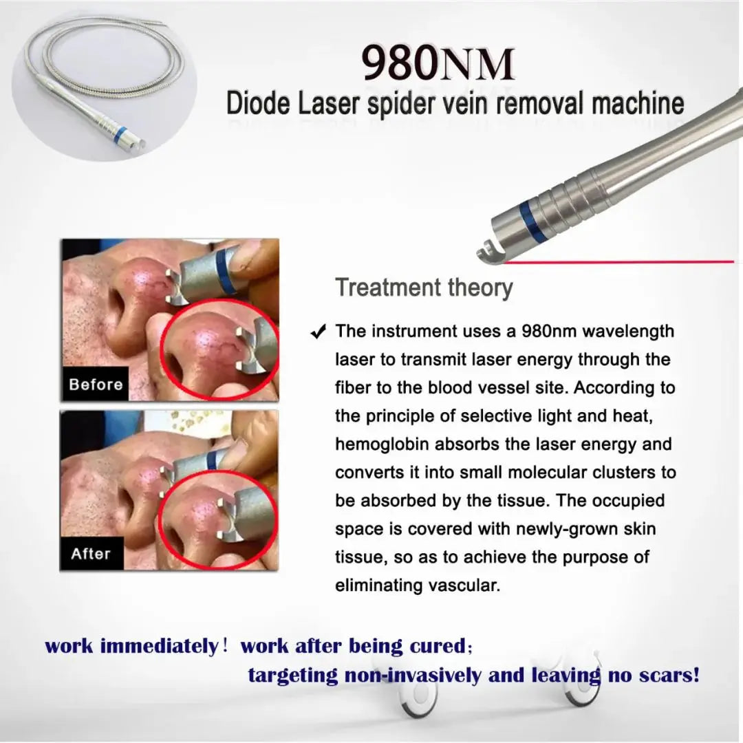 Newest 6 in 1 980nm Diode Laser Therapy Machine Vascular Removal Spider Vein Removal Machine Nail Fungus Laser Onychomycosis