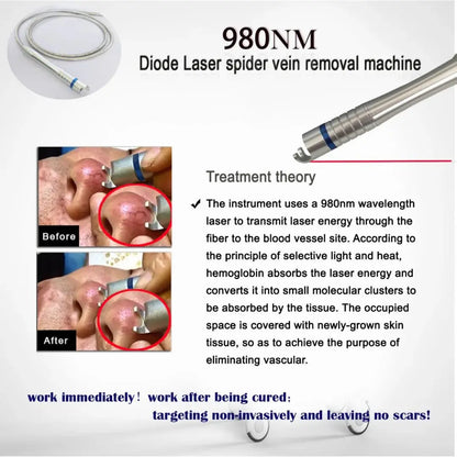 Newest 6 in 1 980nm Diode Laser Therapy Machine Vascular Removal Spider Vein Removal Machine Nail Fungus Laser Onychomycosis