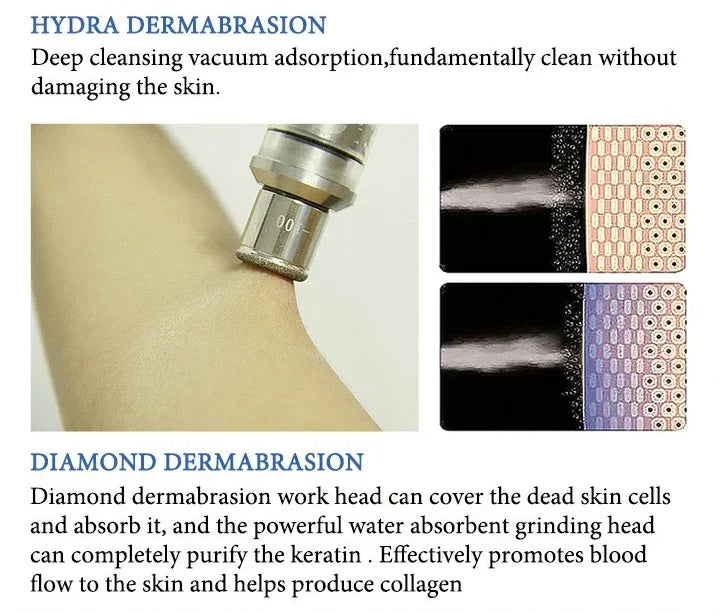 Máquina Hidradermabrasão K 11 em 1 - H2O2 Oxigénio Facial Limpeza Profunda Esfoliação