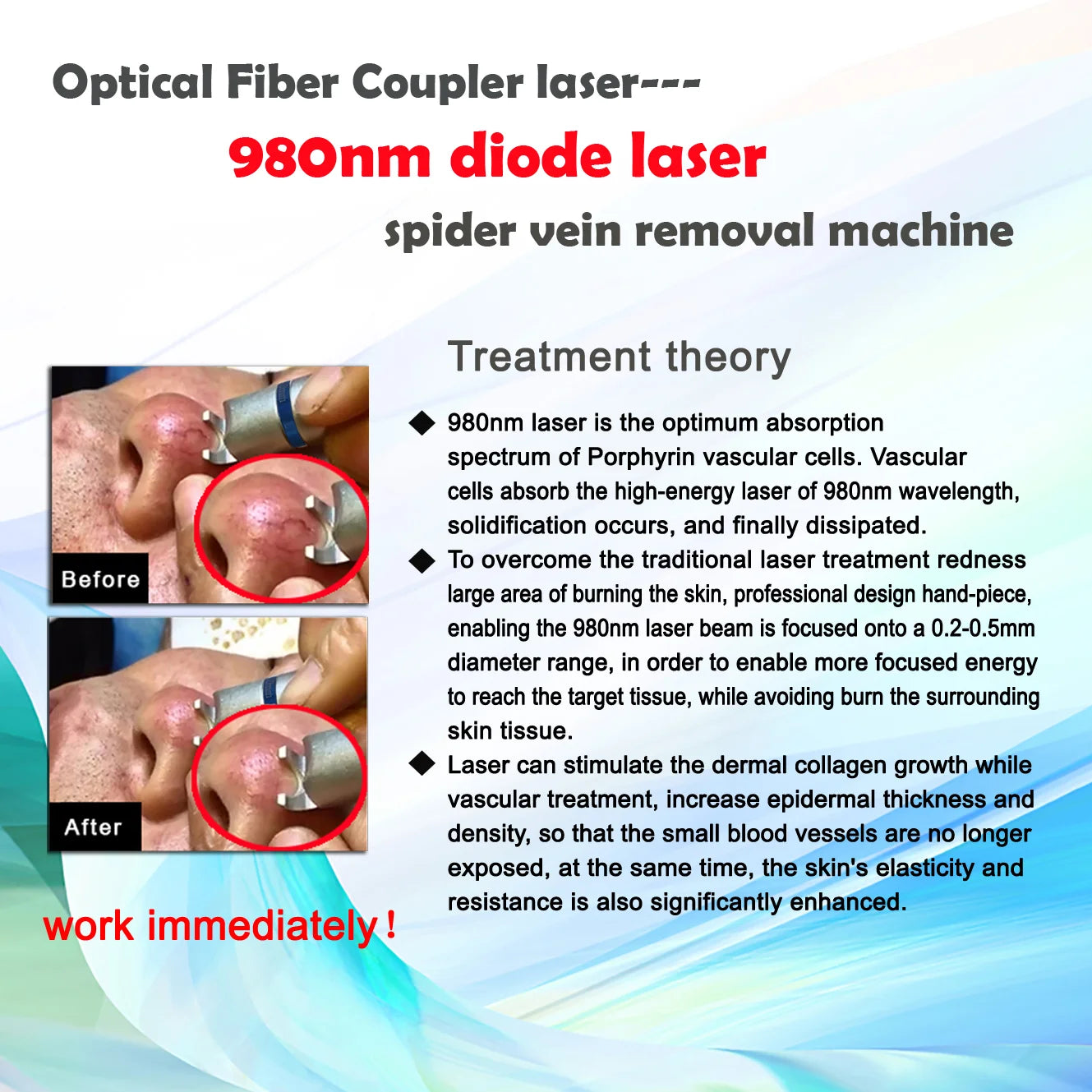 5 in 1 980Nm Diode Laser Physiotherapy Vascular Remove Professional Nail Fungus Laser 980Nm Machine Pain Relief 980Nm Machine