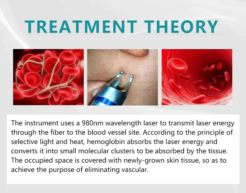Máquina Laser Diodo 2 em 1 - Remoção Vasos Sanguíneos 980nm Tratamento Vascular