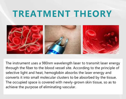 Máquina Laser Diodo 2 em 1 - Remoção Vasos Sanguíneos 980nm Tratamento Vascular