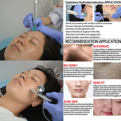 Máquina Hidrodermabrasão 4 em 1 - Limpeza Profunda, Peeling Diamante e Martelo Frio