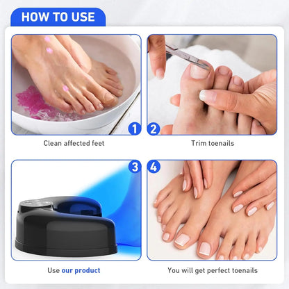 Wireless Nail Fungus Laser Device for Toenails Onychomycosis Infrared Light 470nm 910nm Blue Light Anti Fungal Laser Equipment