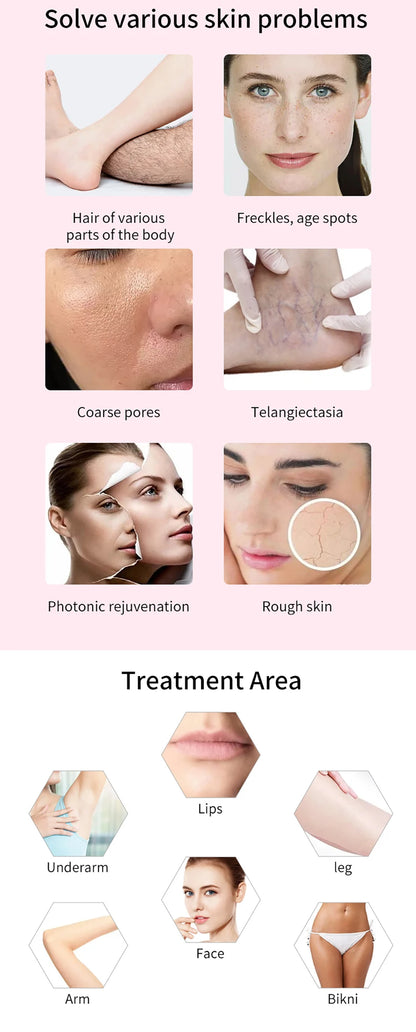 Máquina IPL Profissional Depilação Laser - Equipamento Salão Beleza Remoção Permanente Elight OPT Indolor