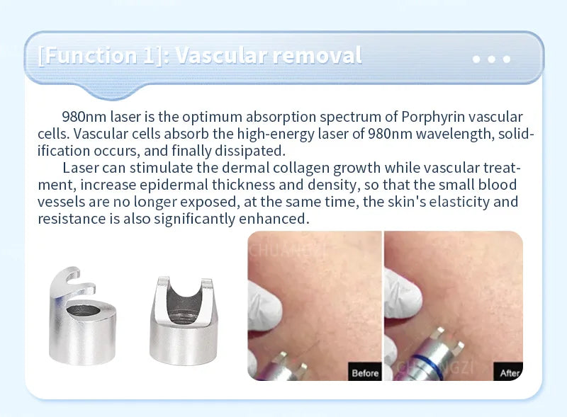 980nm diode laser nail fungus removal spider vein removal physical therapy and Lipolaser reduce cellulase